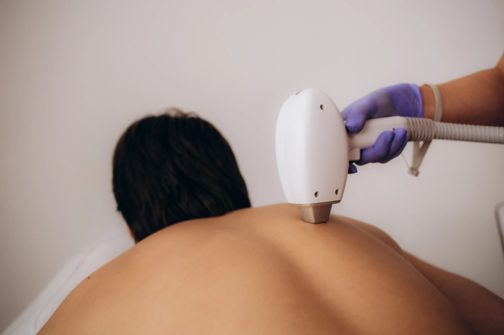 centro de estética en collado villalba | depilacion laser hombre espalda completa