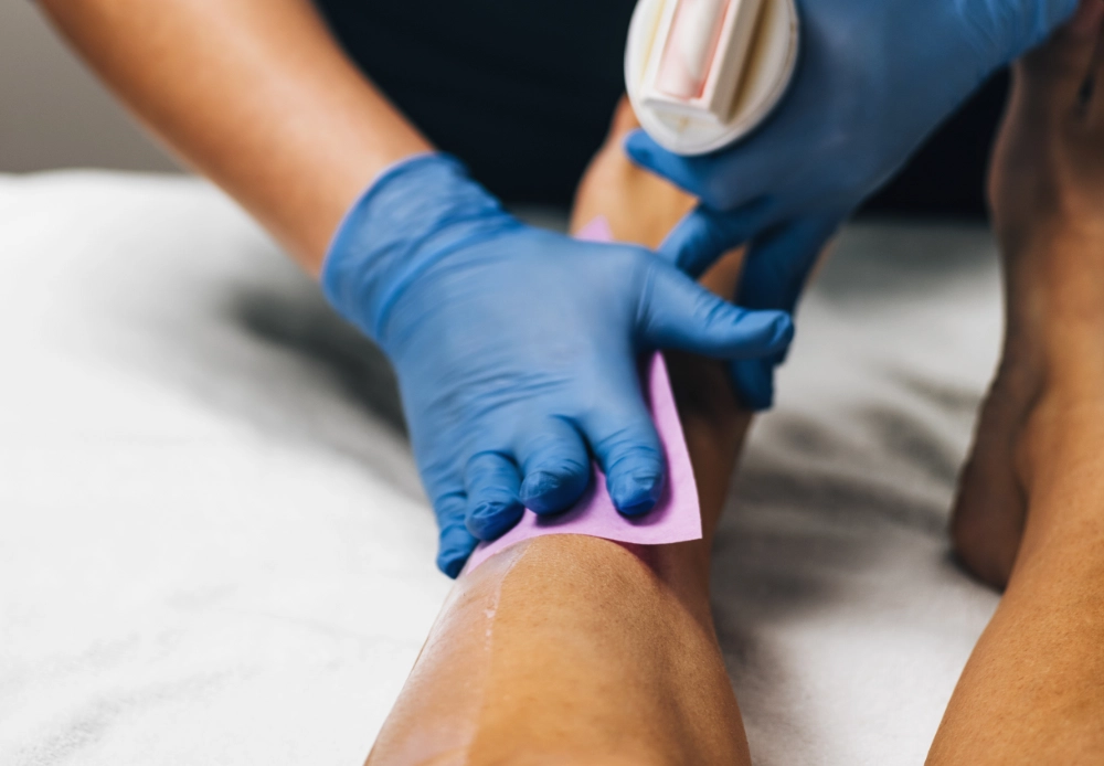 vanestetica tratamiento depilacion laser de piernas y brazos de hombre